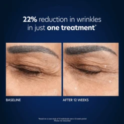 PCA Skin Hyaluronic Acid Microneedle Eye Patches 13 PCA Skin Hyaluronic Acid Microneedle Eye Patches -Skin Care By Alana 32 d2cd7145 65ea 4bb2 b27a 60261b238fb7