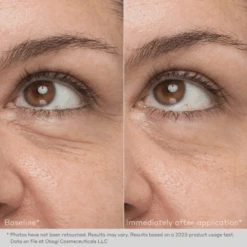 Obagi Daily Hydro-Drops Rejuvenating Eye Gel Cream 0.5oz / 15ml -Skin Care By Alana 6 60c99b33 4f6f 4dae a1aa 542fbf61fcc2