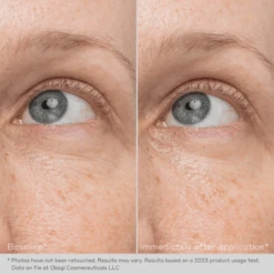 Obagi Daily Hydro-Drops Rejuvenating Eye Gel Cream 0.5oz / 15ml -Skin Care By Alana 7 304a3b9e 46d2 4a3d b9ad 2f2863a90ec4