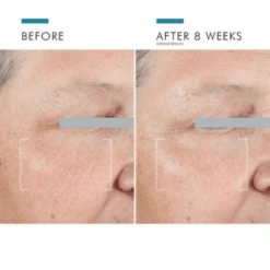 SkinCeuticals A.G.E. Advanced Eye For Dark Circles 0.5oz / 15ml 16 SkinCeuticals A.G.E. Advanced Eye For Dark Circles 0.5oz / 15ml -Skin Care By Alana A.G.E.ADVANCEDEYEFORDARKCIRCLES6