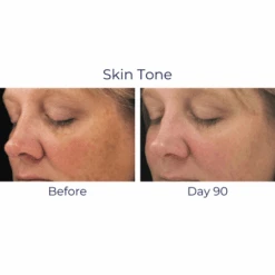 IS Clinical Brightening Complex -Skin Care By Alana Brightening Complex9