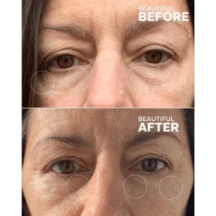 Three Ships First Light Vitamin C + Caffeine Eye Cream 0.5oz / 15ml 8 Three Ships First Light Vitamin C + Caffeine Eye Cream 0.5oz / 15ml - Image 8