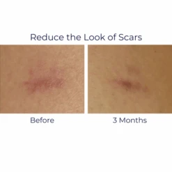 IS Clinical Super Serum Advance+ 15 IS Clinical Super Serum Advance+ -Skin Care By Alana SuperSerum3