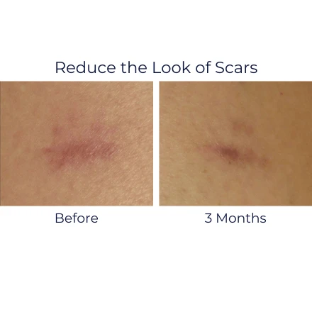 IS Clinical Super Serum Advance+ 5 IS Clinical Super Serum Advance+ - Image 5