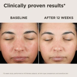 Elta MD UV Skin Recovery Broad Spectrum SPF 50 Face Sunscreen 1.7oz / 50ml -Skin Care By Alana UV Skin5