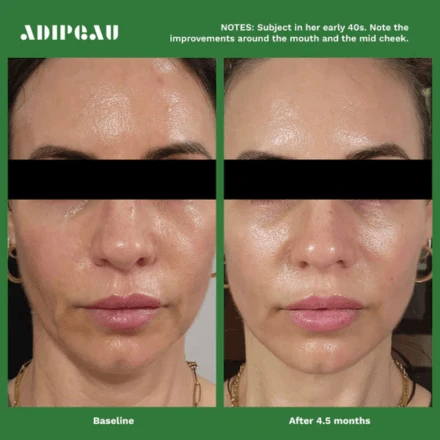 Adipeau Volume Cream 2oz / 60ml 2 Adipeau Volume Cream 2oz / 60ml - Image 2