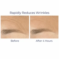 IS Clinical Youth Complex 1oz / 30ml -Skin Care By Alana YouthComplex6