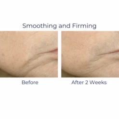 IS Clinical Youth Complex 1oz / 30ml -Skin Care By Alana YouthComplex7