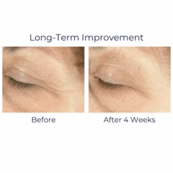 IS Clinical Youth Eye Complex 0.5oz / 15ml 17 IS Clinical Youth Eye Complex 0.5oz / 15ml -Skin Care By Alana YouthComplex8 ddedc97a e473 40a0 8600 7f643a72b529