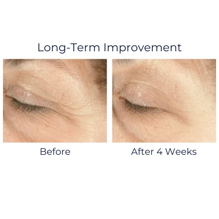 IS Clinical Youth Eye Complex 0.5oz / 15ml 9 IS Clinical Youth Eye Complex 0.5oz / 15ml - Image 9