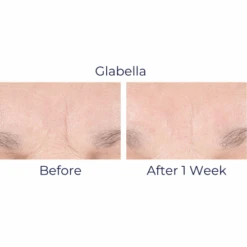 IS Clinical Youth Intensive Creme -Skin Care By Alana YouthIntensiveCreme4 25d5df83 f77d 42e0 9363 0558a7445955