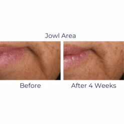 IS Clinical Youth Intensive Creme -Skin Care By Alana YouthIntensiveCreme5