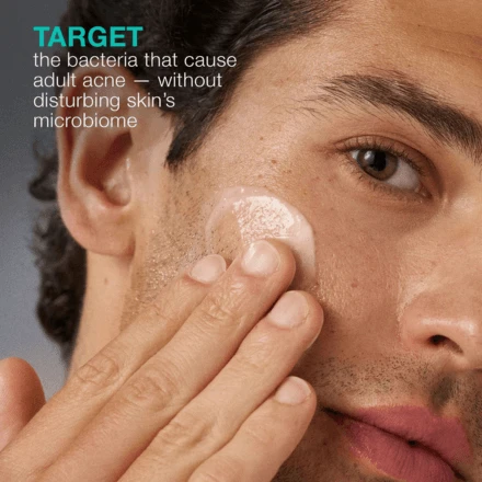 Dermalogica Acne Biotic Moisturizer 1.7oz / 50ml 3 Dermalogica Acne Biotic Moisturizer 1.7oz / 50ml - Image 3