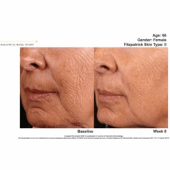 Biojuve Hydrating Barrier Cream 1.69oz / 50ml -Skin Care By Alana b a1 a2121593 86cd 42cf b607 ed762563c9ce