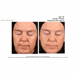 Biojuve Hydrating Barrier Cream 1.69oz / 50ml -Skin Care By Alana b a5 b257abdc 1943 4e8f bfc5 77bc745df70a