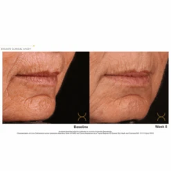 Biojuve Hydrating Barrier Cream 1.69oz / 50ml -Skin Care By Alana b a 862b1734 59fd 43d8 8839 1246b27c6949