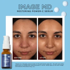 Image Skincare MD Restoring Power C Serum -Skin Care By Alana restoringpower Cserum1